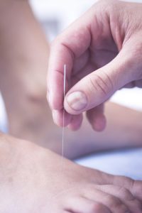 Chiropractor-Bozeman-Dry-Needling-for-Spinal-Pain